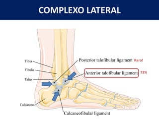 COMPLEXO LATERAL
73%
Raro!
 