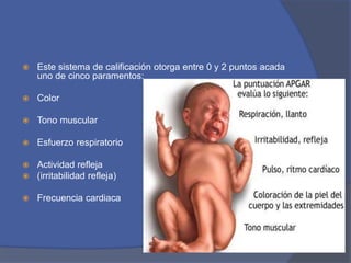 Este sistema de calificación otorga entre 0 y 2 puntos acada
uno de cinco paramentos:
 Color
 Tono muscular
 Esfuerzo respiratorio
 Actividad refleja
 (irritabilidad refleja)
 Frecuencia cardiaca
 