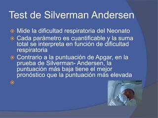 Test de Silverman Andersen
 Mide la dificultad respiratoria del Neonato
 Cada parámetro es cuantificable y la suma
total se interpreta en función de dificultad
respiratoria
 Contrario a la puntuación de Apgar, en la
prueba de Silverman- Andersen, la
puntuación más baja tiene el mejor
pronóstico que la puntuación más elevada

 