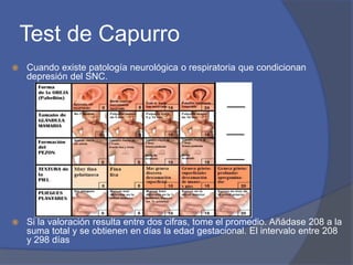 Test de Capurro
 Cuando existe patología neurológica o respiratoria que condicionan
depresión del SNC.
 Si la valoración resulta entre dos cifras, tome el promedio. Añádase 208 a la
suma total y se obtienen en días la edad gestacional. El intervalo entre 208
y 298 días
 