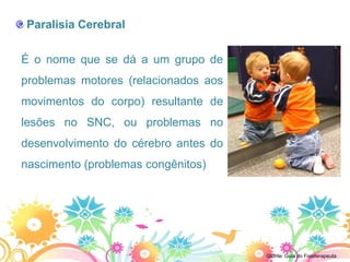 Paralisia Cerebral


É o nome que se dá a um grupo de
problemas motores (relacionados aos
movimentos do corpo) resultante de
lesões no SNC, ou problemas no
desenvolvimento do cérebro antes do
nascimento (problemas congênitos)




                                      Gfonte: Guia do Fisioterapeuta
 