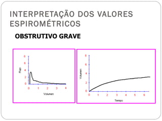 INTERPRETAÇÃO DOS VALORES ESPIROMÉTRICOS OBSTRUTIVO GRAVE 