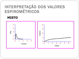 INTERPRETAÇÃO DOS VALORES ESPIROMÉTRICOS MISTO 