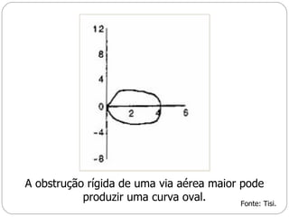 A obstrução rígida de uma via aérea maior pode produzir uma curva oval. Fonte: Tisi. 