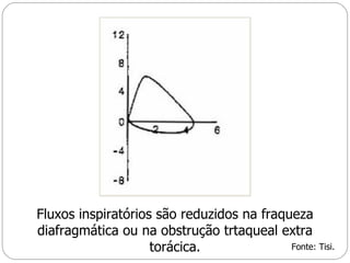Fluxos inspiratórios são reduzidos na fraqueza diafragmática ou na obstrução trtaqueal extra torácica. Fonte: Tisi. 