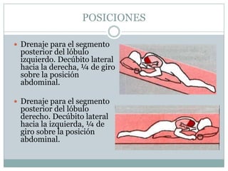 POSICIONES

 Drenaje para el segmento
 posterior del lóbulo
 izquierdo. Decúbito lateral
 hacia la derecha, ¼ de giro
 sobre la posición
 abdominal.

 Drenaje para el segmento
 posterior del lóbulo
 derecho. Decúbito lateral
 hacia la izquierda, ¼ de
 giro sobre la posición
 abdominal.
 