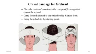 Cravat bandage for forehead
– Place the center of cravat over the compress(dressing) that
covers the wound.
– Carry the ends around to the opposite side & cross them.
– Bring them back to the starting point.
first aid.
2/18/2024 124
 