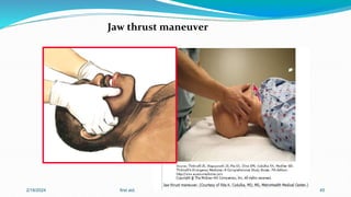 Jaw thrust maneuver
2/18/2024 first aid. 45
 