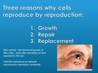 Skin cancer - the abnormal growth of
skin cells - most often develops on skin
exposed to the sun.

Cell that reproduce by asexual
reproduction reproduce constantly.
 