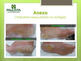 Anexo
( trabalhos executados no estágio)
 