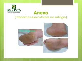 Anexo
( trabalhos executados no estágio)
 
