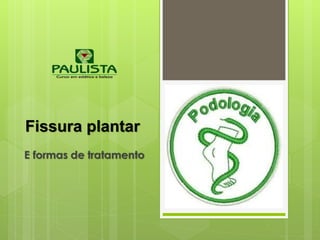 Fissura plantar
E formas de tratamento
 