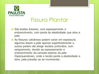 Fissura Plantar
 São lesões lineares, com espessamento e
endurecimento, com perda de elasticidade que abre a
pele.
 As fissuras calcâneas podem variar em espessura;
algumas lesam a pele apenas superficialmente e,
outras podem até atingir tecidos profundos, com
sangramento, devido ao espessamento e
endurecimento da camada externa da pele
(hiperqueratose), onde o tecido perde a elasticidade e
abre, pela pressão ao se movimentar.
 