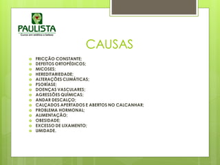 CAUSAS
 FRICÇÃO CONSTANTE;
 DEFEITOS ORTOPÉDICOS;
 MICOSES;
 HEREDITARIEDADE;
 ALTERAÇÕES CLIMÁTICAS;
 PSORÍASE;
 DOENÇAS VASCULARES;
 AGRESSÕES QUÍMICAS;
 ANDAR DESCALÇO;
 CALÇADOS APERTADOS E ABERTOS NO CALCANHAR;
 PROBLEMA HORMONAL;
 ALIMENTAÇÃO;
 OBESIDADE;
 EXCESSO DE LIXAMENTO;
 UMIDADE.
 