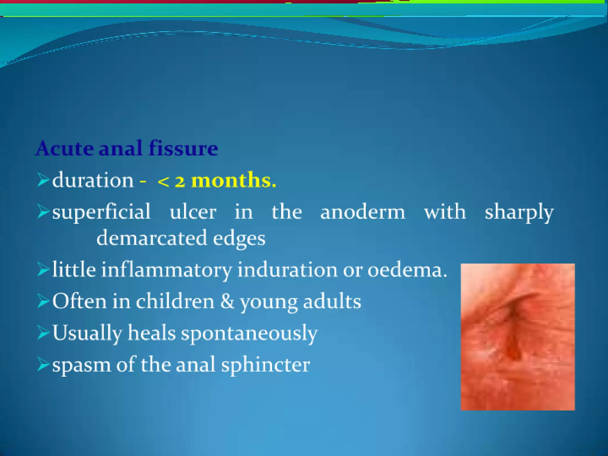 Fissure in-ano- Dr. Enja Amarnath Reddy | PDF