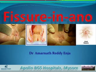 Fissure in-ano- Dr. Enja Amarnath Reddy