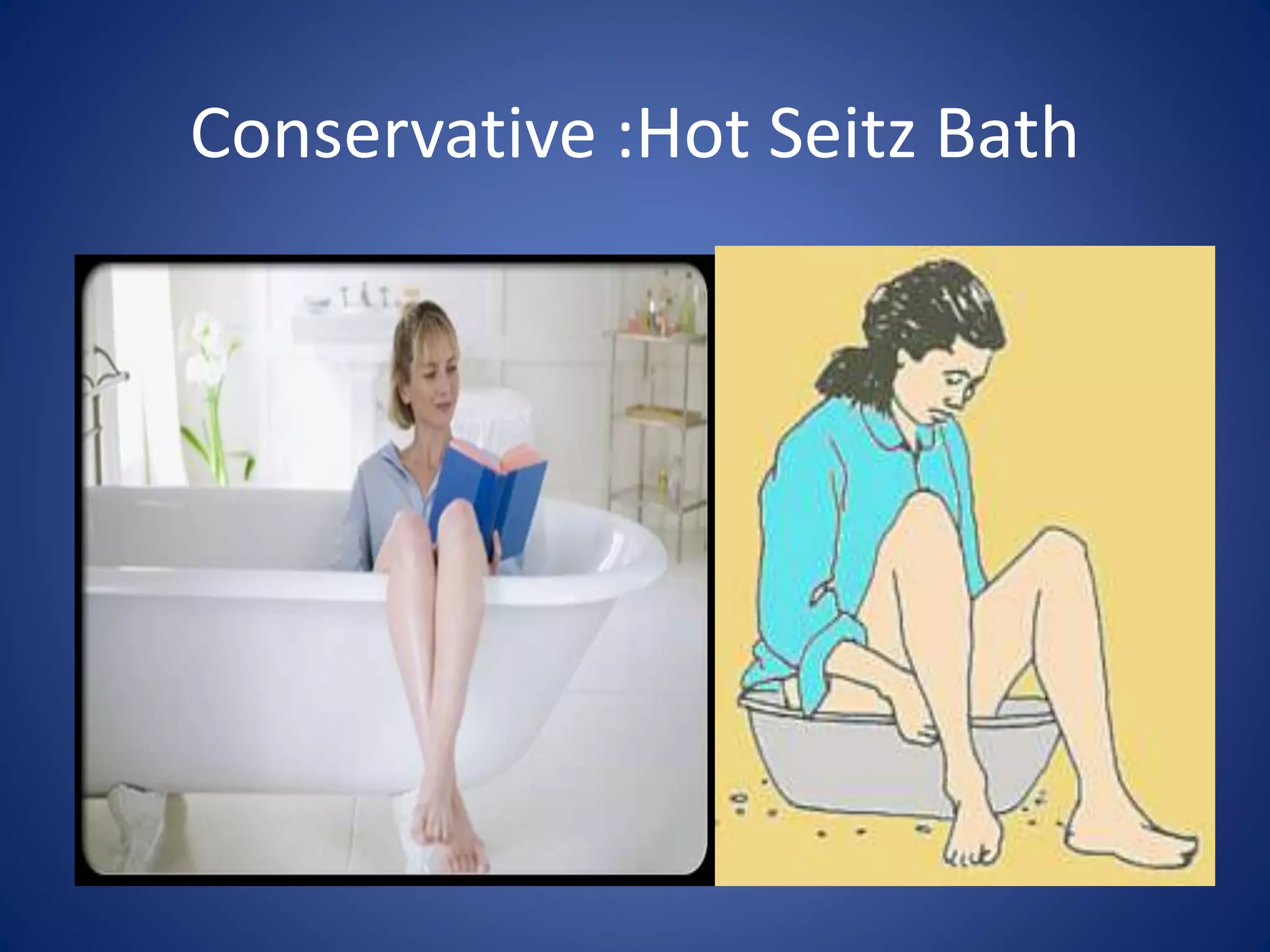 Conservative :Hot Seitz Bath
 
