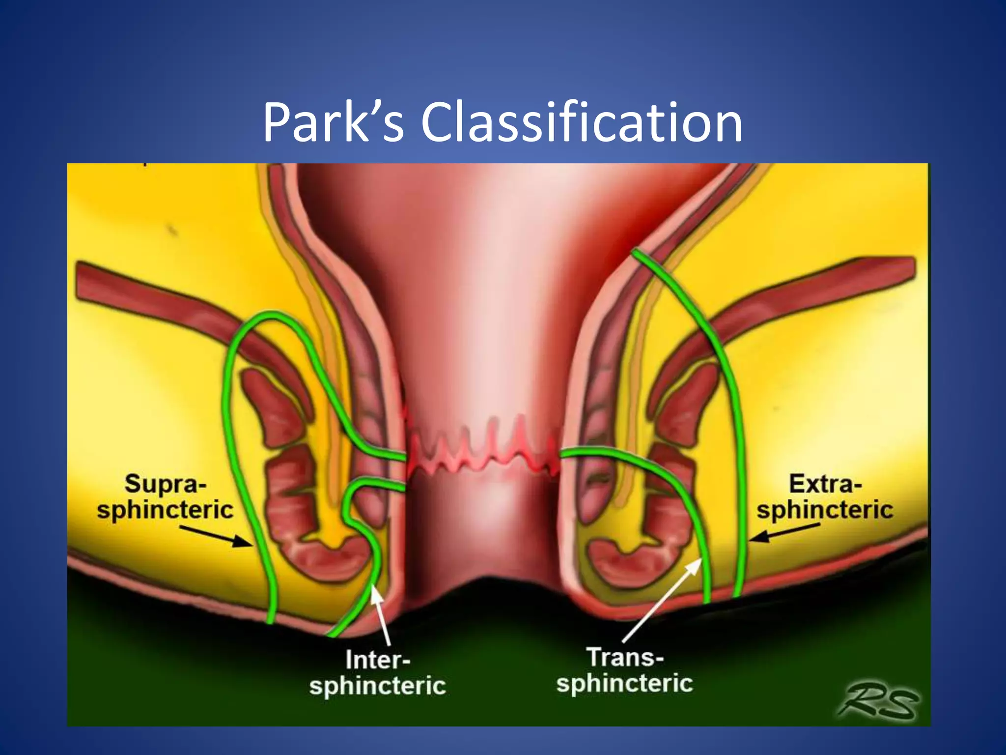 Park’s Classification
 