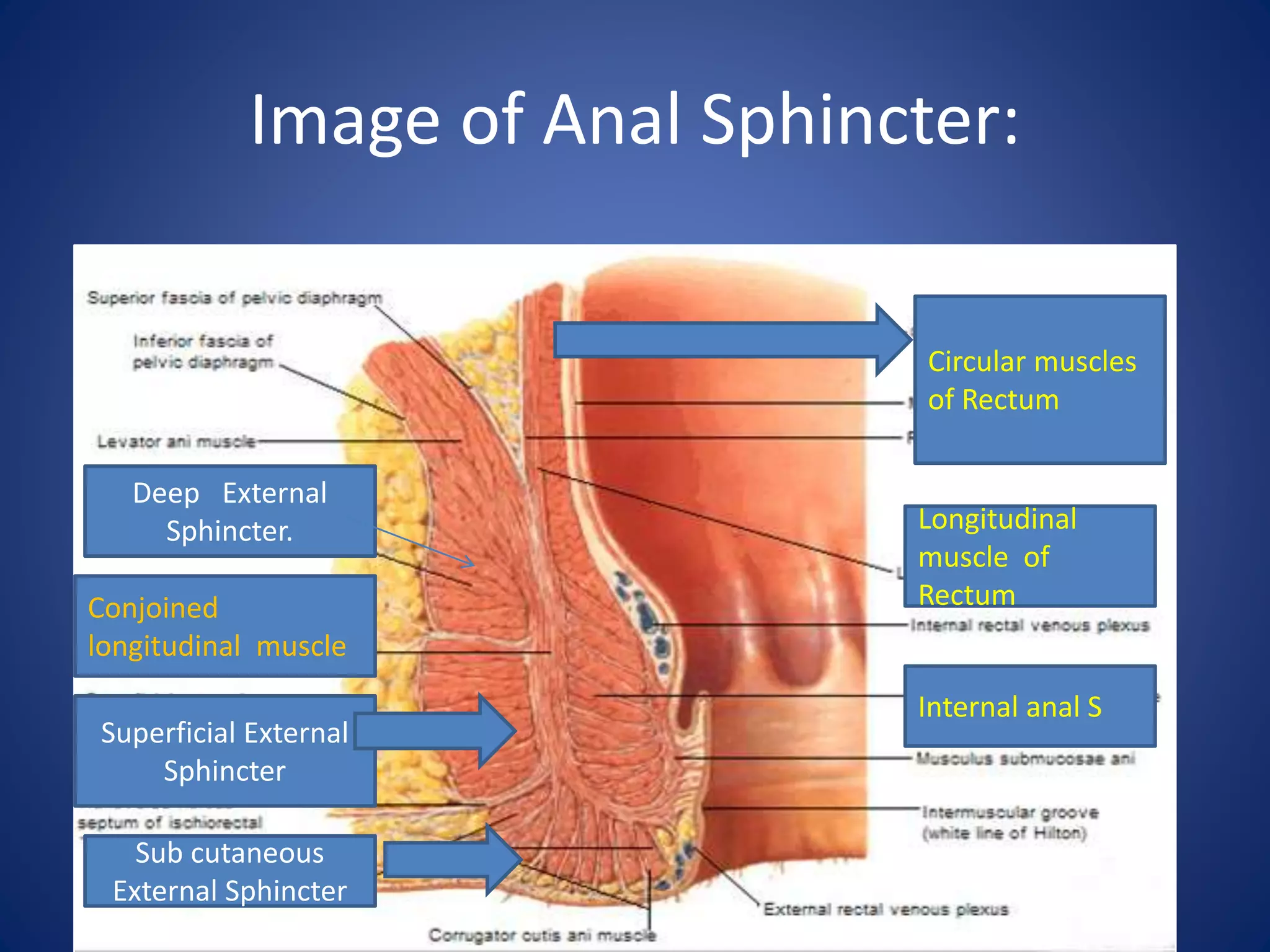 Image of Anal Sphincter:
Deep External
Sphincter.
Sub cutaneous
External Sphincter
Superficial External
Sphincter
Circular muscles
of Rectum
Longitudinal
muscle of
Rectum
Internal anal S
Conjoined
longitudinal muscle
 