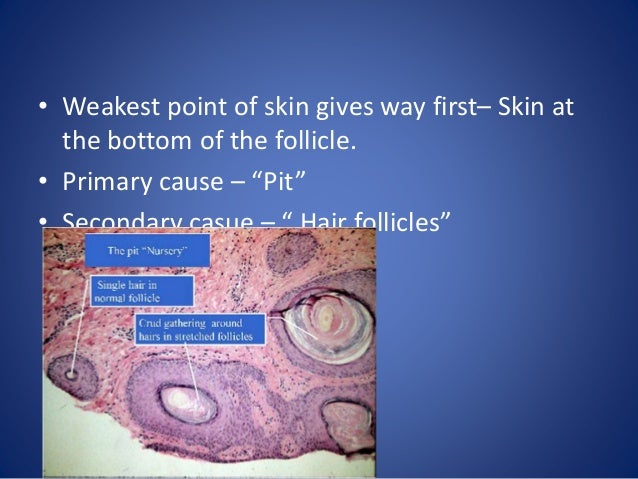 Fissure and fistula