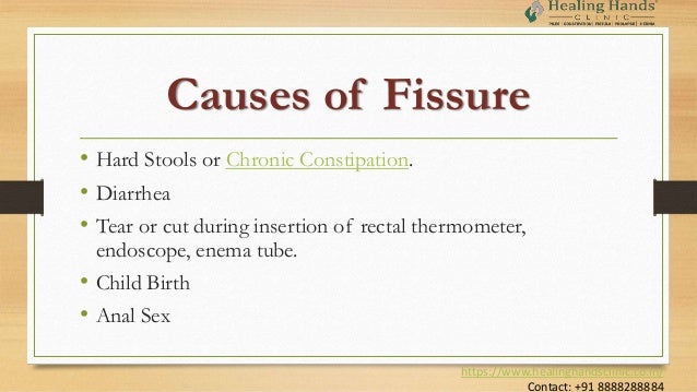 Fissure Causes and Treatment – Healing Hands Clinic