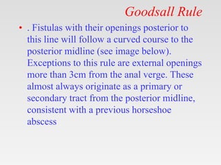 Goodsall Rule
• . Fistulas with their openings posterior to
this line will follow a curved course to the
posterior midline (see image below).
Exceptions to this rule are external openings
more than 3cm from the anal verge. These
almost always originate as a primary or
secondary tract from the posterior midline,
consistent with a previous horseshoe
abscess
 