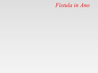 Fistula in Ano
 