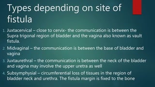 Types depending on site of
fistula
1. Juxtacervical – close to cervix- the communication is between the
Supra trigonal region of bladder and the vagina also known as vault
fistula.
2. Midvaginal – the communication is between the base of bladder and
vagina
3. Juxtaurethral – the communication is between the neck of the bladder
and vagina may involve the upper uretra as well
4. Subsymphysial – circumferential loss of tissues in the region of
bladder neck and urethra. The fistula margin is fixed to the bone
 