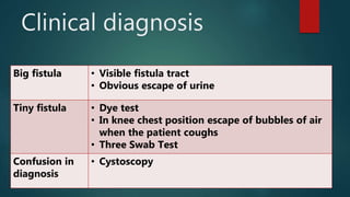 Clinical diagnosis
Big fistula • Visible fistula tract
• Obvious escape of urine
Tiny fistula • Dye test
• In knee chest position escape of bubbles of air
when the patient coughs
• Three Swab Test
Confusion in
diagnosis
• Cystoscopy
 