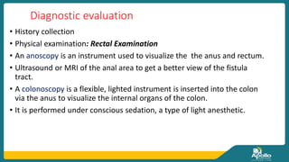 Diagnostic evaluation
• History collection
• Physical examination: Rectal Examination
• An anoscopy is an instrument used to visualize the the anus and rectum.
• Ultrasound or MRI of the anal area to get a better view of the fistula
tract.
• A colonoscopy is a flexible, lighted instrument is inserted into the colon
via the anus to visualize the internal organs of the colon.
• It is performed under conscious sedation, a type of light anesthetic.
 