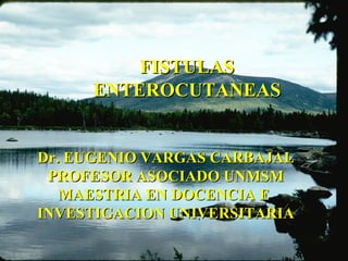 FISTULAS ENTEROCUTANEAS Dr. EUGENIO VARGAS CARBAJAL PROFESOR ASOCIADO UNMSM MAESTRIA EN DOCENCIA E  INVESTIGACION UNIVERSITARIA 