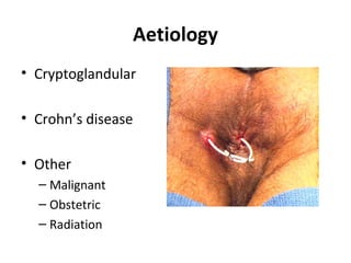 Aetiology
• Cryptoglandular

• Crohn’s disease

• Other
  – Malignant
  – Obstetric
  – Radiation
 