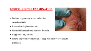 FISTULA-IN-ANO.pptx