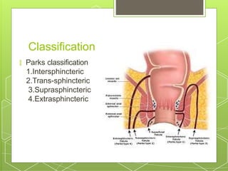 Fistula in ano - classification and management | PPTX