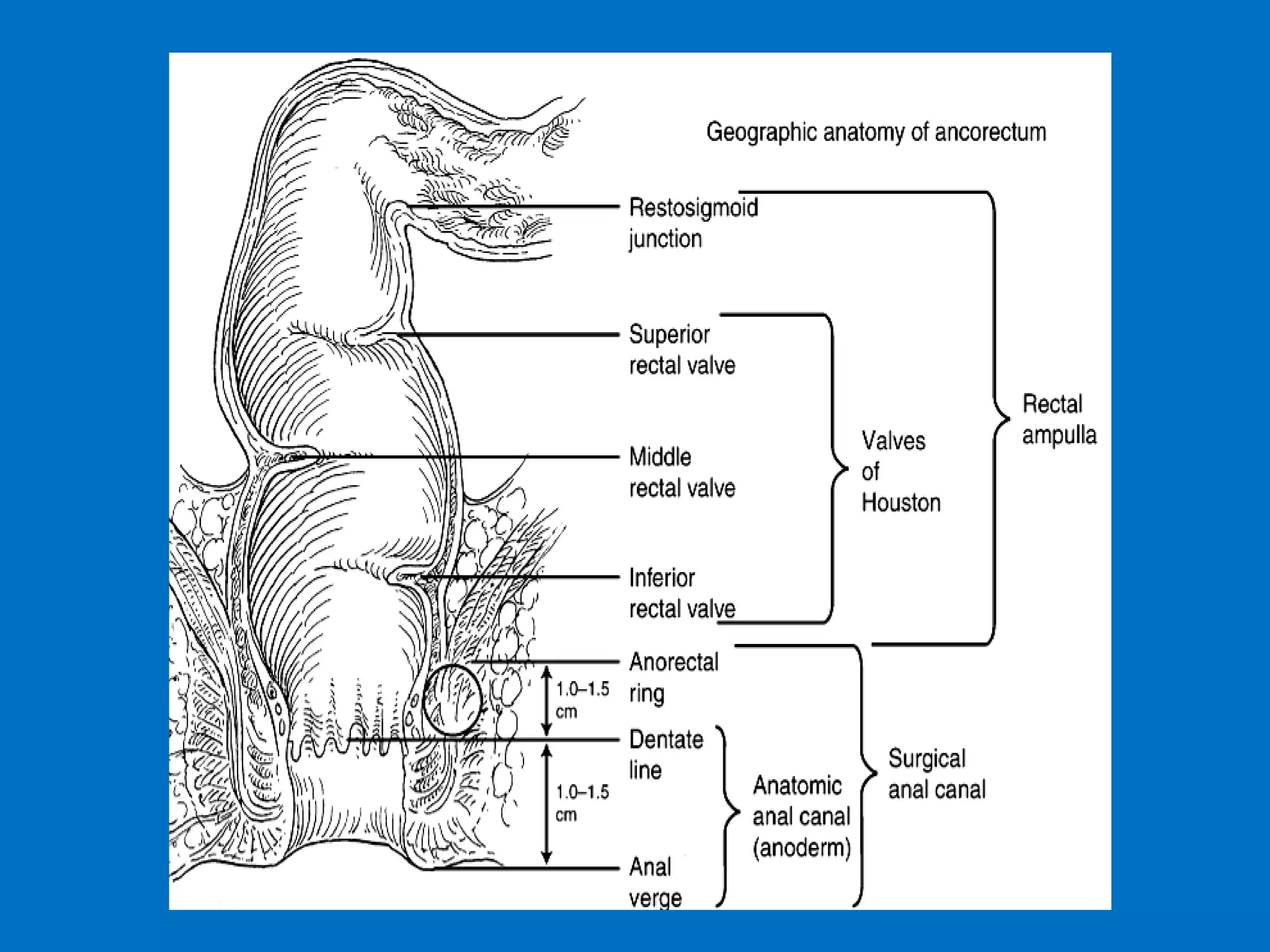 Fistula in-ano | PPT