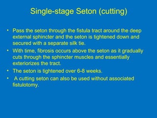 Single-stage Seton (cutting)
• Pass the seton through the fistula tract around the deep
external sphincter and the seton is tightened down and
secured with a separate silk tie.
• With time, fibrosis occurs above the seton as it gradually
cuts through the sphincter muscles and essentially
exteriorizes the tract.
• The seton is tightened over 6-8 weeks.
• A cutting seton can also be used without associated
fistulotomy.
 