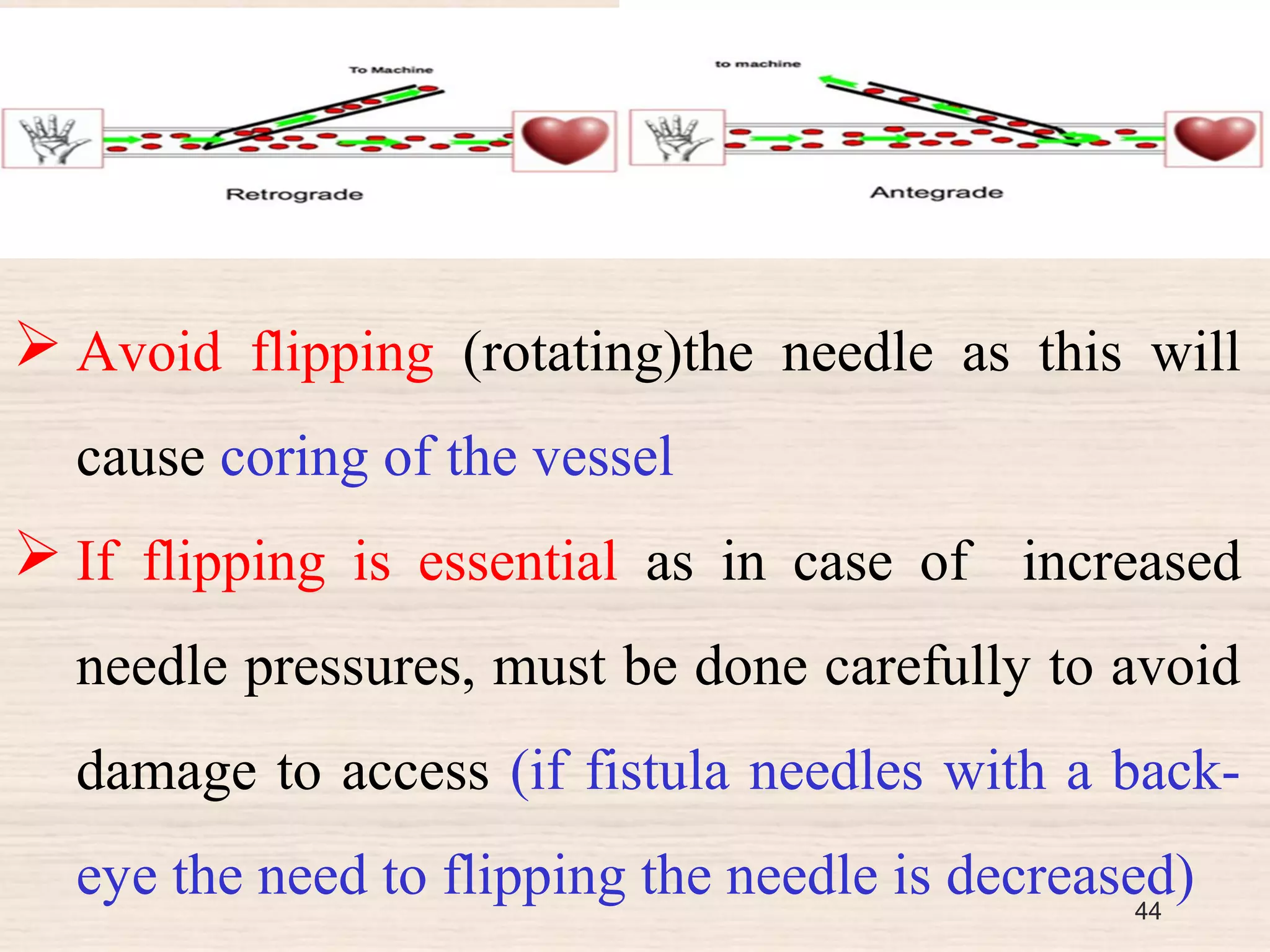 Fistula (Arteriovenous fistula -AVF) | PPT