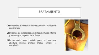 TRATAMIENTO
 El objetivo es erradicar la infección sin sacrificar la
continencia.
 Depende de la localización de las aberturas interna
y externa y el trayecto de la fístula.
 Es necesario tener cuidado para no crear una
abertura interna artificial (fístula simple →
compleja).
 