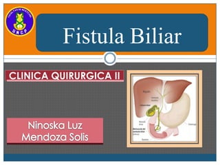 Fistula Biliar
CLINICA QUIRURGICA II

 