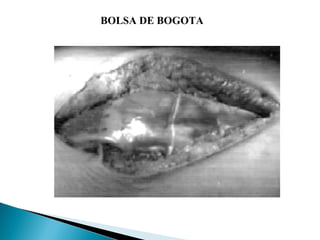 BOLSA DE BOGOTA
 