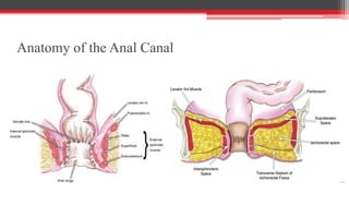 Fistula in ano | PPTX