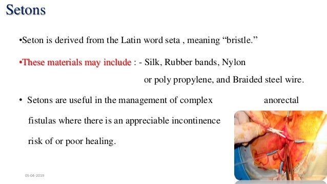Remove Seton Fistula Seton Procedure _ What happens after a failed LIFT for anal ...