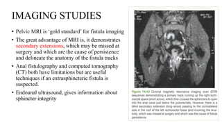 IMAGING STUDIES
• Pelvic MRI is ‘gold standard’ for fistula imaging
• The great advantage of MRI is, it demonstrates
secondary extensions, which may be missed at
surgery and which are the cause of persistence
and delineate the anatomy of the fistula tracks
• Anal fistulography and computed tomography
(CT) both have limitations but are useful
techniques if an extrasphincteric fistula is
suspected.
• Endoanal ultrasound, gives information about
sphincter integrity
 