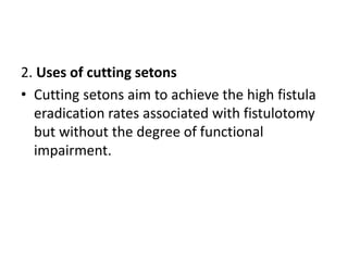 Remove Seton Fistula in ANO | PPTX