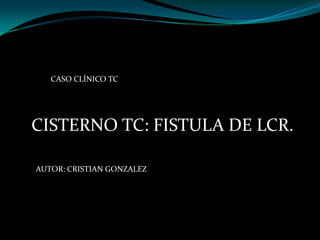 CASO CLÍNICO TC
CISTERNO TC: FISTULA DE LCR.
AUTOR: CRISTIAN GONZALEZ
 