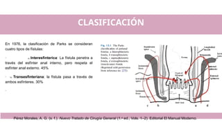CLASIFICACIÓN
En 1976, la clasificación de Parks se consideran
cuatro tipos de fístulas:
· a) Interesfinterica: La fístula penetra a
través del esfínter anal interno, pero respeta el
esfínter anal externo. 45%
· b) Transesfinteriana: la fístula pasa a través de
ambos esfínteres. 30%
·
Pérez Morales, A. G. (s. f.). Nuevo Tratado de Cirugía General (1.a
ed., Vols. 1–2). Editorial El Manual Moderno.
 