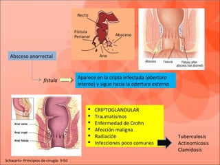 Absceso anorrectal
Aparece en la cripta infectada (abertura
interna) y sigue hacia la abertura externa
fístula
 CRIPTOGLANDULAR
 Traumatismos
 Enfermedad de Crohn
 Afección maligna
 Radiación
 Infecciones poco comunes
Tuberculosis
Actinomicosis
Clamidosis
Schwarts- Principios de cirugía- 9 Ed
 