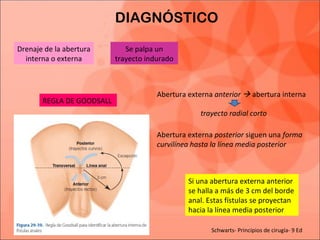 DIAGNÓSTICO
Drenaje de la abertura
interna o externa
Se palpa un
trayecto indurado
REGLA DE GOODSALL
Abertura externa anterior  abertura interna
Abertura externa posterior siguen una forma
curvilínea hasta la línea media posterior
trayecto radial corto
Si una abertura externa anterior
se halla a más de 3 cm del borde
anal. Estas fístulas se proyectan
hacia la línea media posterior
Schwarts- Principios de cirugía- 9 Ed
 