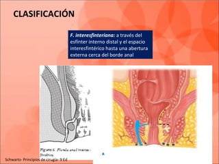CLASIFICACIÓN
F. interesfinteriana: a través del
esfínter interno distal y el espacio
interesfintérico hasta una abertura
externa cerca del borde anal
Schwarts- Principios de cirugía- 9 Ed
 