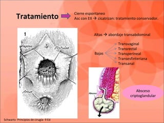Cierre espontaneo
Asc con EII  cicatrizan: tratamiento conservador.Tratamiento
Altas  abordaje transabdominal
Bajas
Transvaginal
Transrectal
Transperineal
Transesfinteriana
Transanal
Absceso
criptoglandular
Schwarts- Principios de cirugía- 9 Ed
 